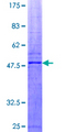 SOCS2 Protein - 12.5% SDS-PAGE of human SOCS2 stained with Coomassie Blue