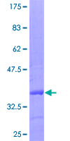 SOCS2 Protein - 12.5% SDS-PAGE Stained with Coomassie Blue.
