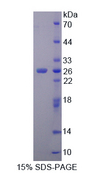 SOCS2 Protein - Recombinant  Suppressors Of Cytokine Signaling 2 By SDS-PAGE