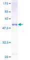 SOCS3 Protein - 12.5% SDS-PAGE of human SOCS3 stained with Coomassie Blue