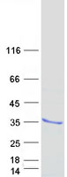 SOCS3 Protein - Purified recombinant protein SOCS3 was analyzed by SDS-PAGE gel and Coomassie Blue Staining