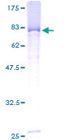 SOCS4 Protein - 12.5% SDS-PAGE of human SOCS4 stained with Coomassie Blue