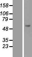 SOCS5 Protein - Western validation with an anti-DDK antibody * L: Control HEK293 lysate R: Over-expression lysate