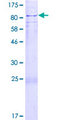 SOCS5 Protein - 12.5% SDS-PAGE of human SOCS5 stained with Coomassie Blue