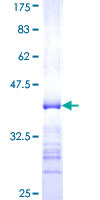 SOCS5 Protein - 12.5% SDS-PAGE Stained with Coomassie Blue.