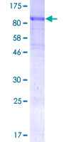 SOCS6 / SOCS-6 Protein - 12.5% SDS-PAGE of human SOCS6 stained with Coomassie Blue