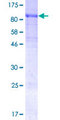 SOCS6 / SOCS-6 Protein - 12.5% SDS-PAGE of human SOCS6 stained with Coomassie Blue