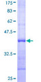 SOCS7 / SOCS-7 Protein - 12.5% SDS-PAGE Stained with Coomassie Blue.