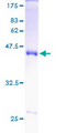 SOD1 / Cu-Zn SOD Protein - 12.5% SDS-PAGE of human SOD1 stained with Coomassie Blue