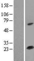 SOD2 / Mn SOD Protein - Western validation with an anti-DDK antibody * L: Control HEK293 lysate R: Over-expression lysate