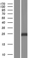 SOD2 / Mn SOD Protein - Western validation with an anti-DDK antibody * L: Control HEK293 lysate R: Over-expression lysate