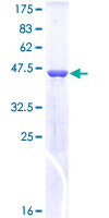 SOD2 / Mn SOD Protein - 12.5% SDS-PAGE of human SOD2 stained with Coomassie Blue