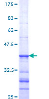 SOD2 / Mn SOD Protein - 12.5% SDS-PAGE Stained with Coomassie Blue.
