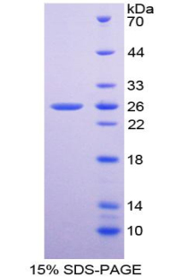 SOD2 / Mn SOD Protein - Recombinant Superoxide Dismutase 2, Mitochondrial By SDS-PAGE