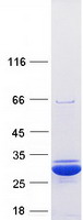 SOD2 / Mn SOD Protein - Purified recombinant protein SOD2 was analyzed by SDS-PAGE gel and Coomassie Blue Staining