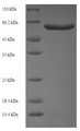 SOD3 Protein - (Tris-Glycine gel) Discontinuous SDS-PAGE (reduced) with 5% enrichment gel and 15% separation gel.