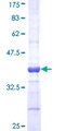 SOD3 Protein - 12.5% SDS-PAGE Stained with Coomassie Blue.