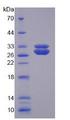 SOD3 Protein - Recombinant Superoxide Dismutase 3, Extracellular By SDS-PAGE