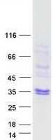 SOD3 Protein - Purified recombinant protein SOD3 was analyzed by SDS-PAGE gel and Coomassie Blue Staining
