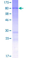 SOGA1 Protein - 12.5% SDS-PAGE of human C20orf117 stained with Coomassie Blue
