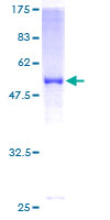 SOHLH2 Protein - 12.5% SDS-PAGE of human FLJ20449 stained with Coomassie Blue