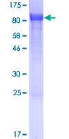 SOLO / SESTD1 Protein - 12.5% SDS-PAGE of human SESTD1 stained with Coomassie Blue