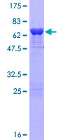 SORBS3 / Vinexin Protein - 12.5% SDS-PAGE of human SORBS3 stained with Coomassie Blue