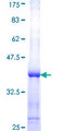 SORCS2 Protein - 12.5% SDS-PAGE Stained with Coomassie Blue.