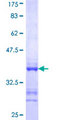 SORCS3 Protein - 12.5% SDS-PAGE Stained with Coomassie Blue.