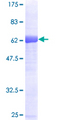 SORD / Sorbitol Dehydrogenase Protein - 12.5% SDS-PAGE of human SORD stained with Coomassie Blue