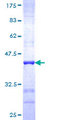 SORD / Sorbitol Dehydrogenase Protein - 12.5% SDS-PAGE Stained with Coomassie Blue.