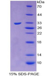 SORD / Sorbitol Dehydrogenase Protein - Recombinant Sorbitol Dehydrogenase By SDS-PAGE