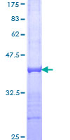 SORL1 Protein - 12.5% SDS-PAGE Stained with Coomassie Blue.