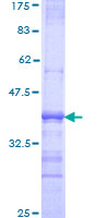 SORT1 / Sortilin Protein - 12.5% SDS-PAGE Stained with Coomassie Blue.
