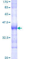 SOS1 Protein - 12.5% SDS-PAGE Stained with Coomassie Blue.