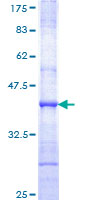 SOS2 Protein - 12.5% SDS-PAGE Stained with Coomassie Blue.