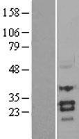 SOST / Sclerostin Protein - Western validation with an anti-DDK antibody * L: Control HEK293 lysate R: Over-expression lysate