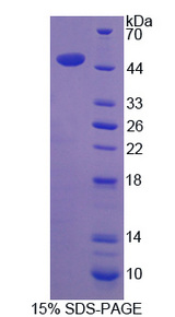 SOST / Sclerostin Protein - Recombinant Sclerostin By SDS-PAGE