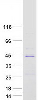 SOWAHD / ANKRD58 Protein - Purified recombinant protein SOWAHD was analyzed by SDS-PAGE gel and Coomassie Blue Staining