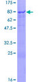 SOX10 Protein - 12.5% SDS-PAGE of human SOX10 stained with Coomassie Blue