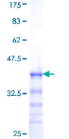 SOX10 Protein - 12.5% SDS-PAGE Stained with Coomassie Blue.