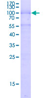 SOX11 Protein - 12.5% SDS-PAGE of human SOX11 stained with Coomassie Blue