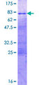 SOX12 Protein - 12.5% SDS-PAGE of human SOX12 stained with Coomassie Blue