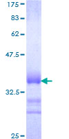 SOX12 Protein - 12.5% SDS-PAGE Stained with Coomassie Blue.