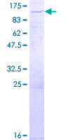 SOX13 Protein - 12.5% SDS-PAGE of human SOX13 stained with Coomassie Blue