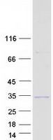 SOX14 Protein - Purified recombinant protein SOX14 was analyzed by SDS-PAGE gel and Coomassie Blue Staining