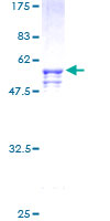 SOX15 Protein - 12.5% SDS-PAGE of human SOX15 stained with Coomassie Blue