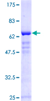 SOX2 Protein - 12.5% SDS-PAGE of human SOX2 stained with Coomassie Blue