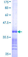 SOX2 Protein - 12.5% SDS-PAGE Stained with Coomassie Blue.