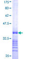 SOX2 Protein - 12.5% SDS-PAGE Stained with Coomassie Blue.